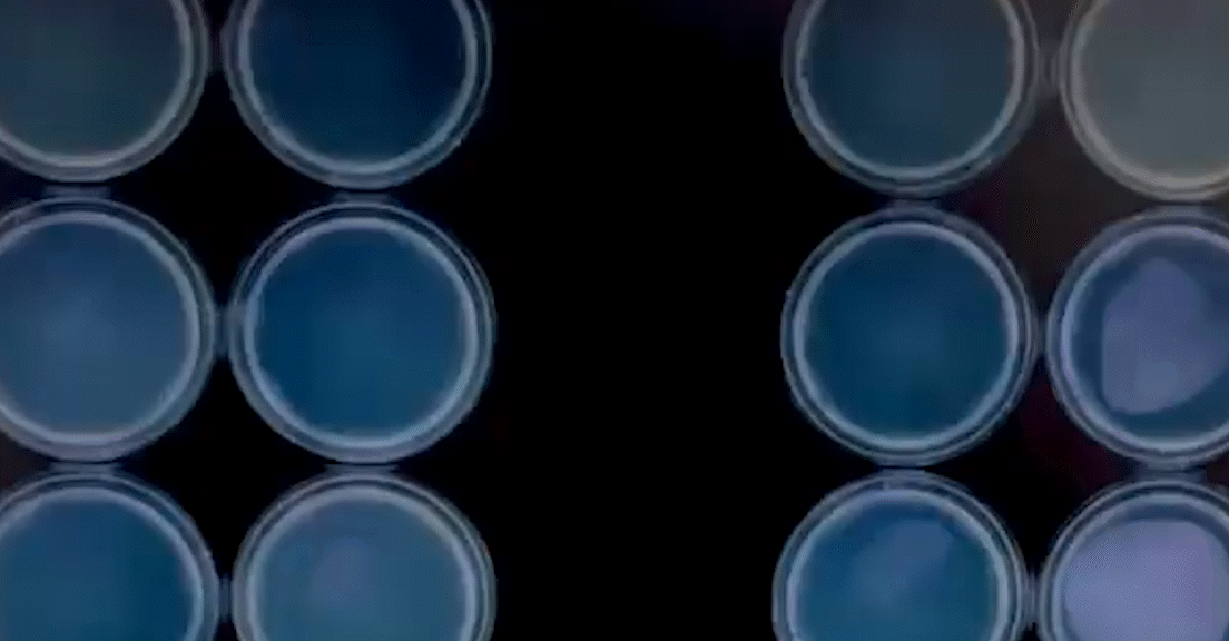 24 hour timelapse of soil bacteria growth